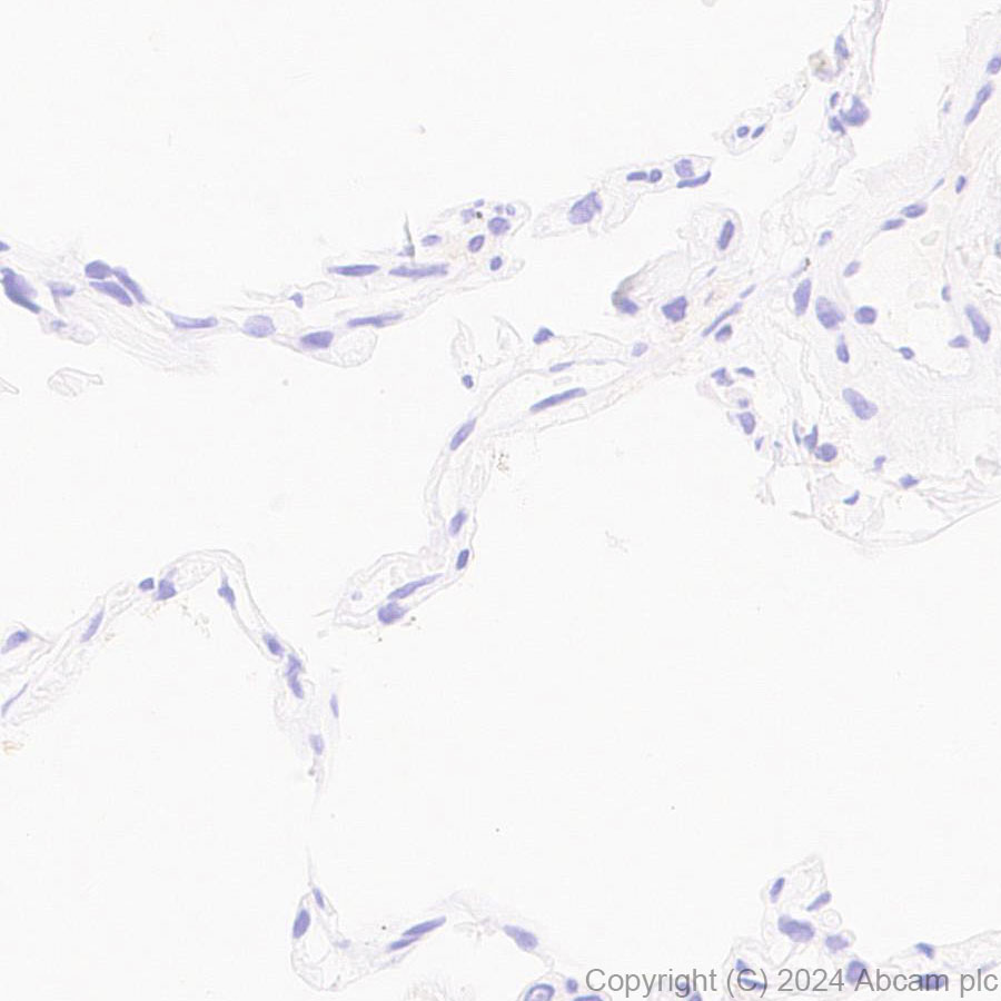 Immunohistochemistry (Formalin/PFA-fixed paraffin-embedded sections) - Anti-B7-H6 antibody [EPR28658-68] - BSA and Azide free (AB316976), expandable thumbnail