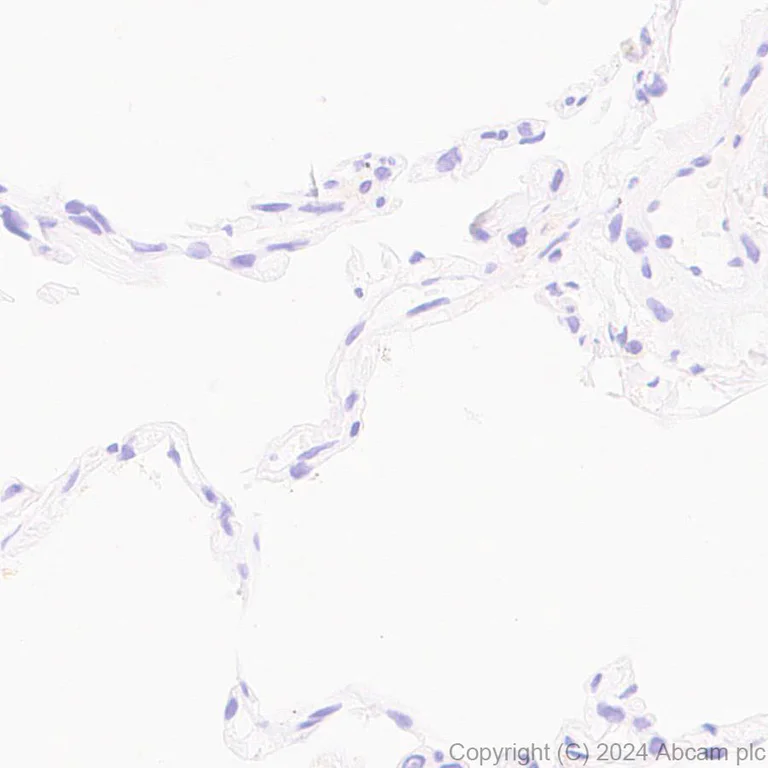 Immunohistochemistry (Formalin/PFA-fixed paraffin-embedded sections) - Anti-B7-H6 antibody [EPR28658-68] - BSA and Azide free (AB316976)