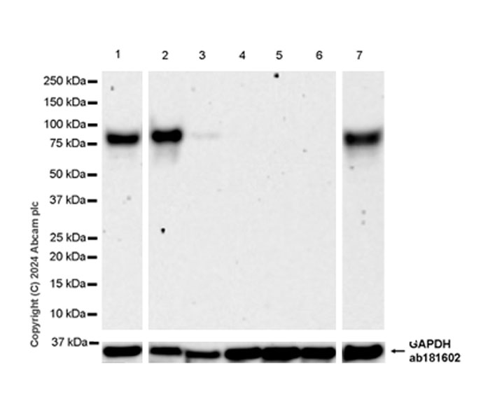 Western blot - Anti-B7-H6 antibody [EPR28658-68] - BSA and Azide free (AB316976), expandable thumbnail