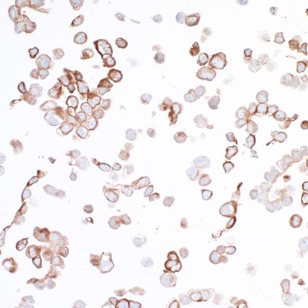 Immunocytochemistry - Anti-B7H4 antibody [BLR043F] (AB243899)