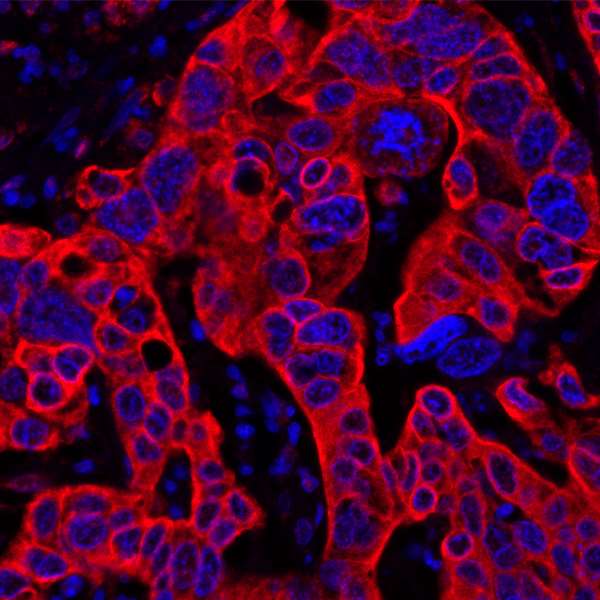 Immunohistochemistry (Formalin/PFA-fixed paraffin-embedded sections) - Anti-B7H4 antibody [BLR043F] (AB243899)