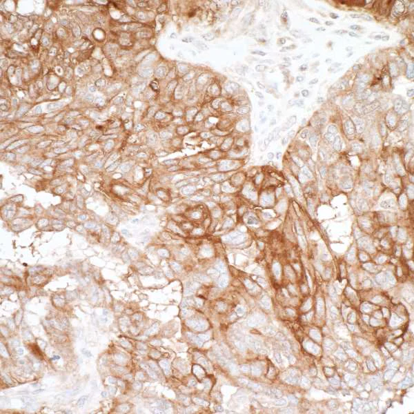 Immunohistochemistry (Formalin/PFA-fixed paraffin-embedded sections) - Anti-B7H4 antibody [BLR043F] (AB243899)