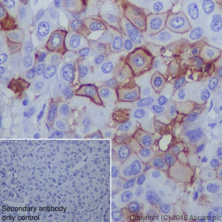 Immunohistochemistry (Formalin/PFA-fixed paraffin-embedded sections) - Anti-B7H4 antibody [EPR20236] (AB209242), expandable thumbnail
