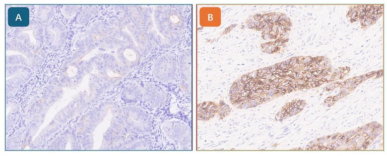 Immunohistochemistry (Formalin/PFA-fixed paraffin-embedded sections) - Anti-B7H4 antibody [EPR20236] (AB209242)