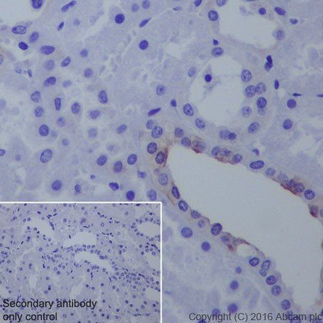 Immunohistochemistry (Formalin/PFA-fixed paraffin-embedded sections) - Anti-B7H4 antibody [EPR20236] (AB209242), expandable thumbnail
