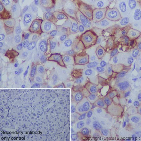 Immunohistochemistry (Formalin/PFA-fixed paraffin-embedded sections) - Anti-B7H4 antibody [EPR20236] - BSA and Azide free (AB271987)