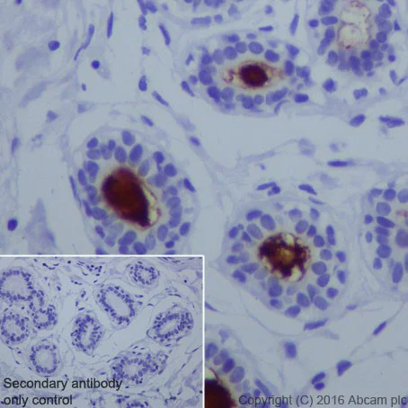 Immunohistochemistry (Formalin/PFA-fixed paraffin-embedded sections) - Anti-B7H4 antibody [EPR20236] - Low endotoxin, Azide free (AB222927)