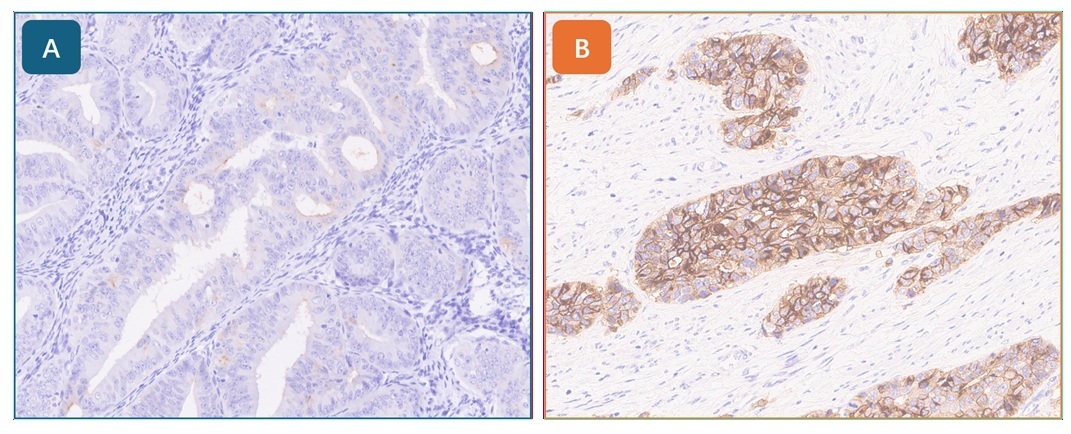 Immunohistochemistry (Formalin/PFA-fixed paraffin-embedded sections) - Anti-B7H4 antibody [EPR20236] - Low endotoxin, Azide free (AB222927)