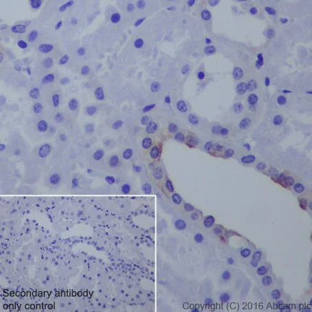 Immunohistochemistry (Formalin/PFA-fixed paraffin-embedded sections) - Anti-B7H4 antibody [EPR20236] - Low endotoxin, Azide free (AB222927)