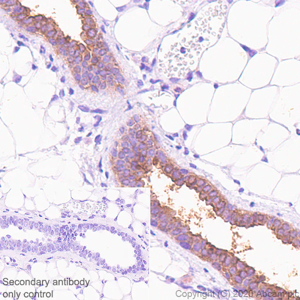 Immunohistochemistry (Formalin/PFA-fixed paraffin-embedded sections) - Anti-B7H4 antibody [EPR23665-20] (AB252438)