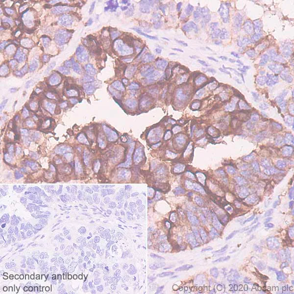 Immunohistochemistry (Formalin/PFA-fixed paraffin-embedded sections) - Anti-B7H4 antibody [EPR23665-20] - BSA and Azide free (AB272707)