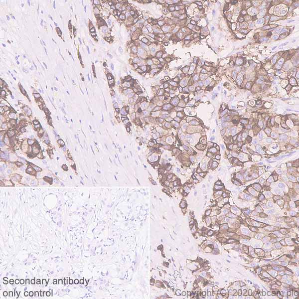 Immunohistochemistry (Formalin/PFA-fixed paraffin-embedded sections) - Anti-B7H4 antibody [EPR23665-20] - BSA and Azide free (AB272707)