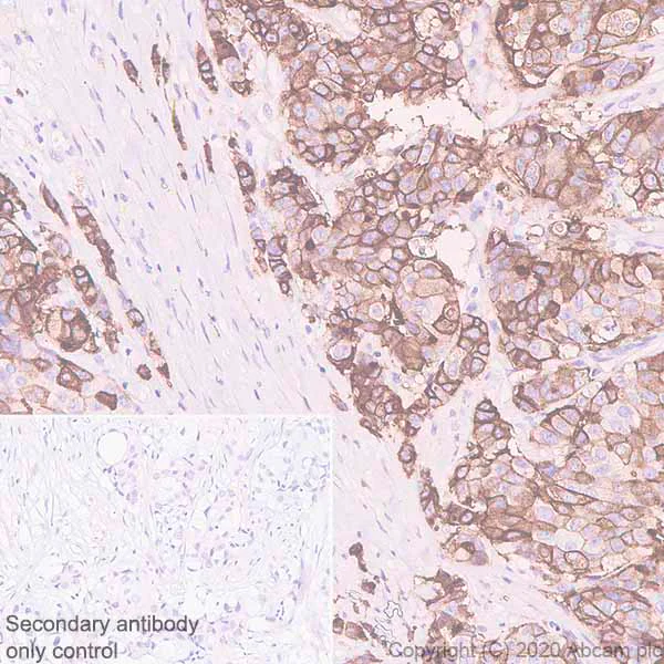 Immunohistochemistry (Formalin/PFA-fixed paraffin-embedded sections) - Anti-B7H4 antibody [EPR23665-20] - BSA and Azide free (AB272707)