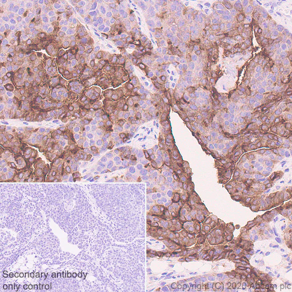 Immunohistochemistry (Formalin/PFA-fixed paraffin-embedded sections) - Anti-B7H4 antibody [EPR23665-20] - BSA and Azide free (AB272707)