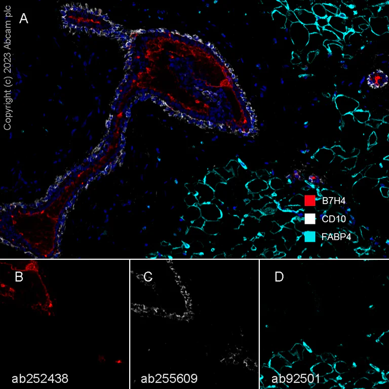 Multiplex immunohistochemistry - Anti-B7H4 antibody [EPR23665-20] - BSA and Azide free (AB272707)