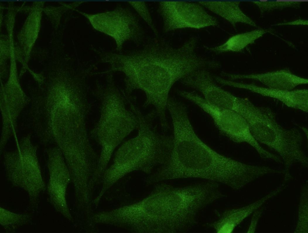Immunocytochemistry - Anti-BACE1 antibody [027] - BSA and Azide free (AB277127), expandable thumbnail