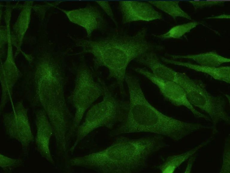 Immunocytochemistry - Anti-BACE1 antibody [027] - BSA and Azide free (AB277127)