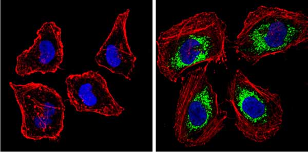 Immunocytochemistry/ Immunofluorescence - Anti-BACE1 antibody (AB10716), expandable thumbnail