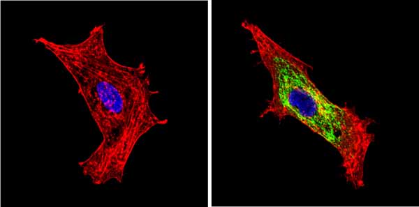 Immunocytochemistry/ Immunofluorescence - Anti-BACE1 antibody (AB10716), expandable thumbnail