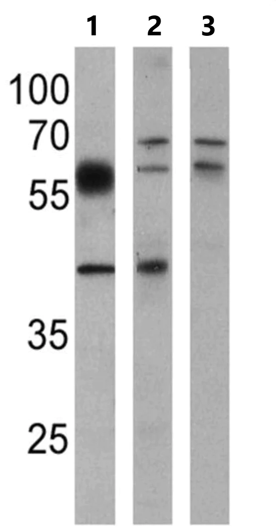 Western blot - Anti-BACE1 antibody (AB10716)