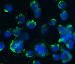 Immunocytochemistry/ Immunofluorescence - Anti-BACE1 antibody (AB2077)