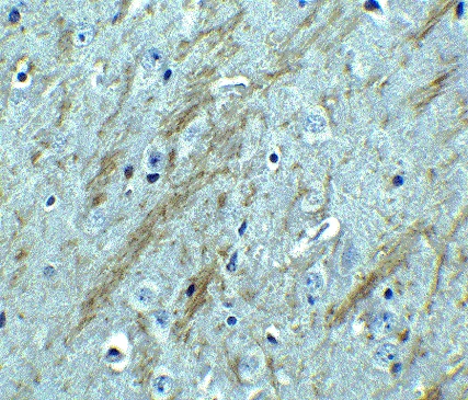 Immunohistochemistry (Formalin/PFA-fixed paraffin-embedded sections) - Anti-BACE1 antibody (AB2077)