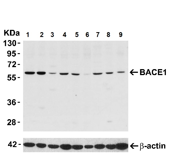 Western blot - Anti-BACE1 antibody (AB2077), expandable thumbnail