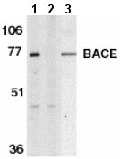 Western blot - Anti-BACE1 antibody (ab2077), expandable thumbnail
