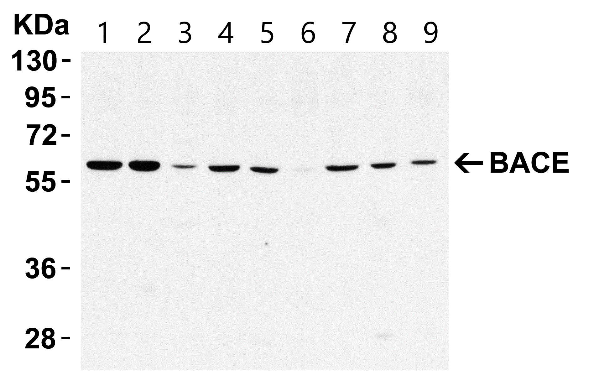 Western blot - Anti-BACE1 antibody (ab2077), expandable thumbnail