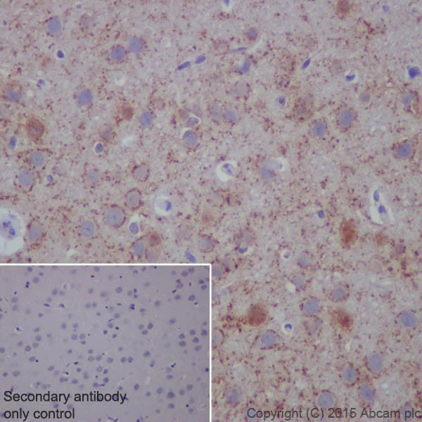 Immunohistochemistry (Formalin/PFA-fixed paraffin-embedded sections) - Anti-BACE1 antibody [EPR19523] (AB183612)