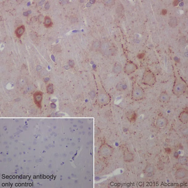 Immunohistochemistry (Formalin/PFA-fixed paraffin-embedded sections) - Anti-BACE1 antibody [EPR19523] (AB183612)