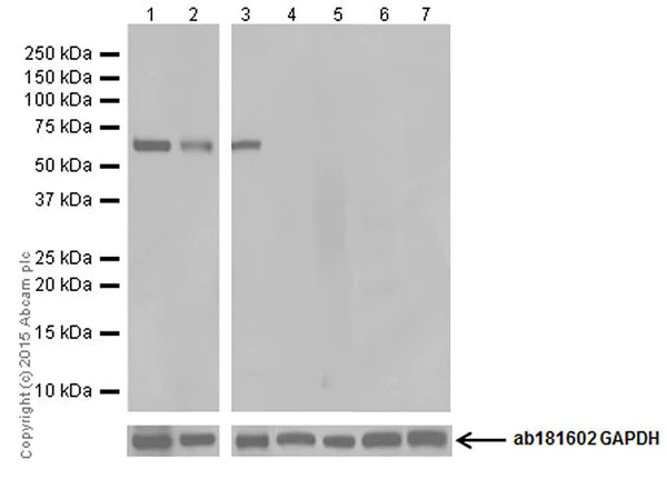 Western blot - Anti-BACE1 antibody [EPR19523] (AB183612)