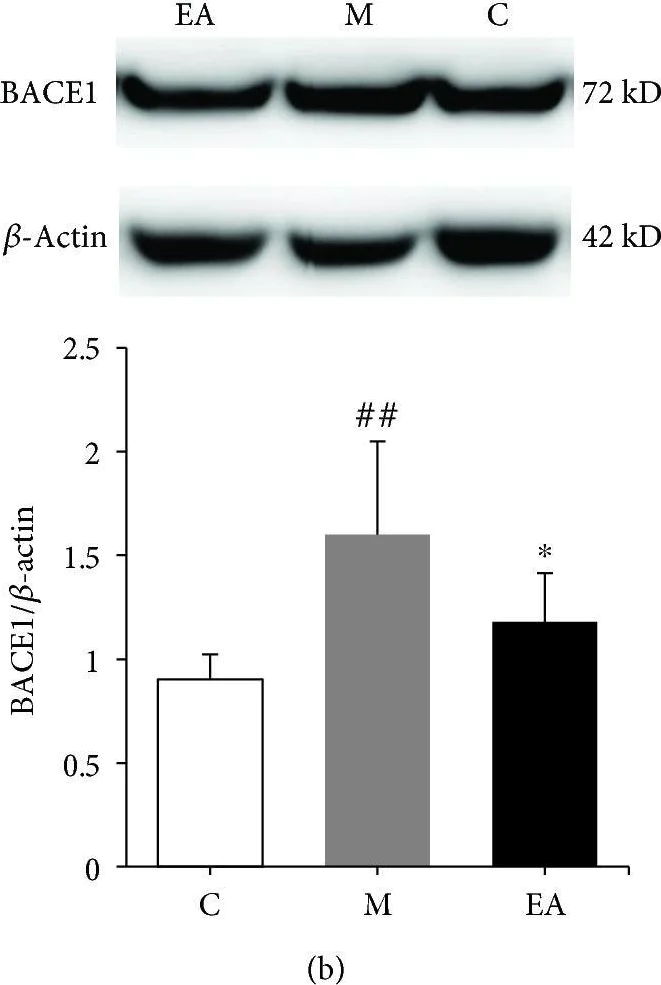 Western blot - Anti-BACE1 antibody [EPR19523] (AB183612)