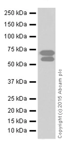 Western blot - Anti-BACE1 antibody [EPR19523] (AB183612)