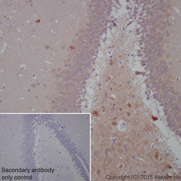 Immunohistochemistry (Formalin/PFA-fixed paraffin-embedded sections) - Anti-BACE1 antibody [EPR19523] - BSA and Azide free (ab238937), expandable thumbnail
