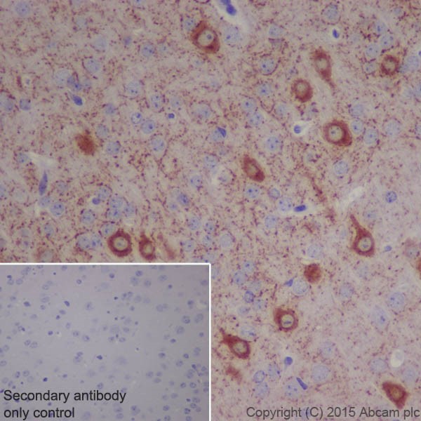 Immunohistochemistry (Formalin/PFA-fixed paraffin-embedded sections) - Anti-BACE1 antibody [EPR19523] - BSA and Azide free (AB238937), expandable thumbnail