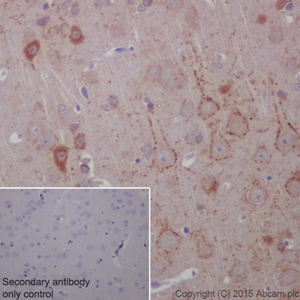 Immunohistochemistry (Formalin/PFA-fixed paraffin-embedded sections) - Anti-BACE1 antibody [EPR19523] - BSA and Azide free (AB238937), expandable thumbnail