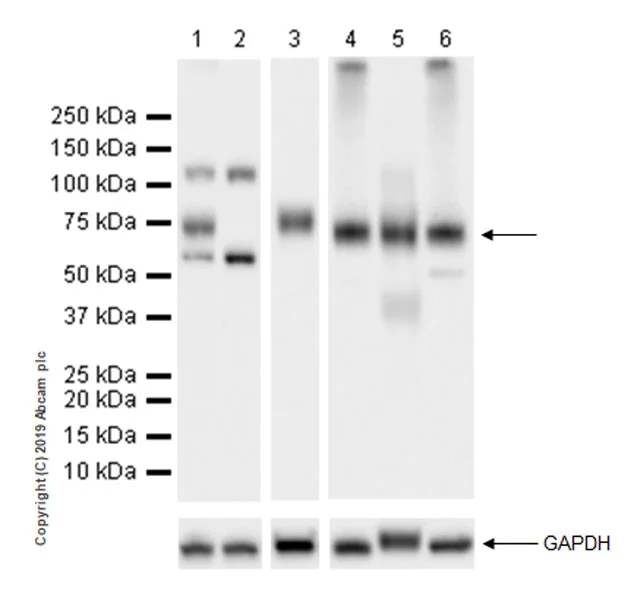 Western blot - Anti-BACE1 antibody [EPR22802-233] (AB263901)