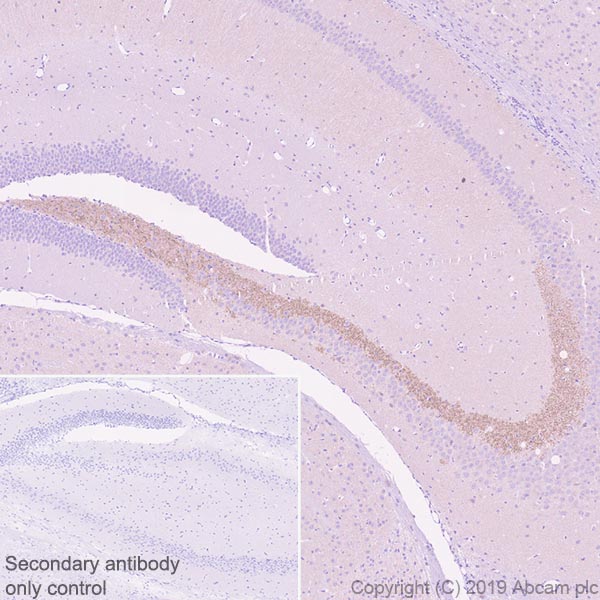 Immunohistochemistry (Formalin/PFA-fixed paraffin-embedded sections) - Anti-BACE1 antibody [EPR22802-233] - BSA and Azide free (AB267796), expandable thumbnail