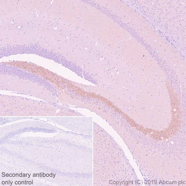 Immunohistochemistry (Formalin/PFA-fixed paraffin-embedded sections) - Anti-BACE1 antibody [EPR22802-233] - BSA and Azide free (AB267796)