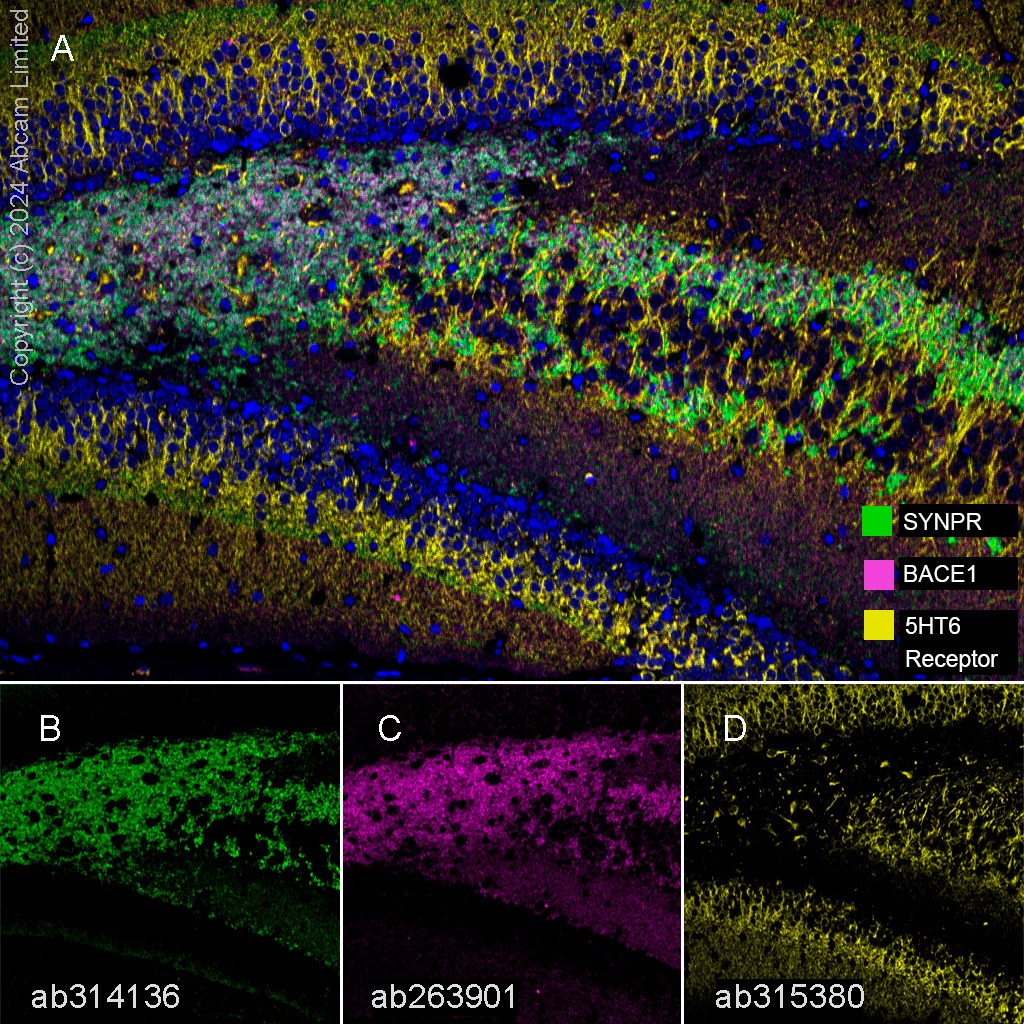 Multiplex immunohistochemistry - Anti-BACE1 antibody [EPR22802-233] - BSA and Azide free (AB267796), expandable thumbnail
