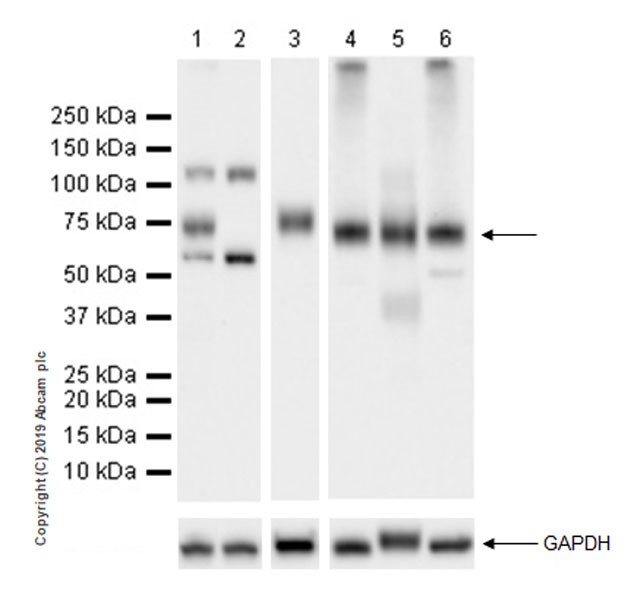Western blot - Anti-BACE1 antibody [EPR22802-233] - BSA and Azide free (AB267796), expandable thumbnail