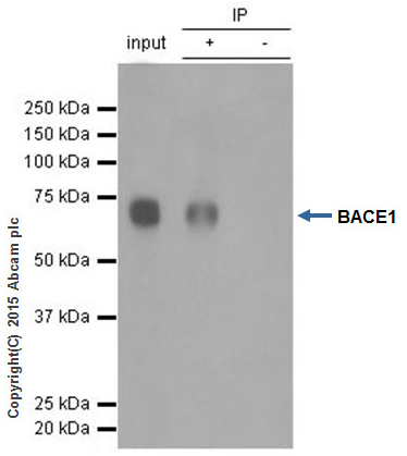 Immunoprecipitation - Anti-BACE1 antibody [EPR3956] (AB108394), expandable thumbnail