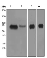 Western blot - Anti-BACE1 antibody [EPR3956] (AB108394)