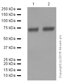 Western blot - Anti-BACE1 antibody [EPR3956] (AB108394), expandable thumbnail