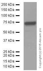 Western blot - Anti-BACE1 antibody [EPR3956] (AB108394)
