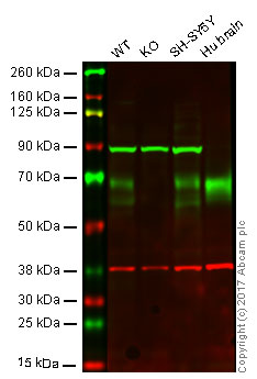 Western blot - Anti-BACE1 antibody [EPR3956] - BSA and Azide free (AB237595), expandable thumbnail