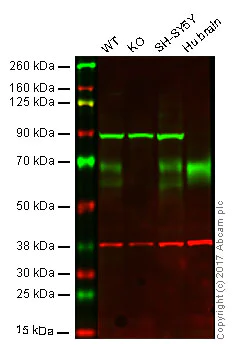 Western blot - Anti-BACE1 antibody [EPR3956] - BSA and Azide free (AB237595)