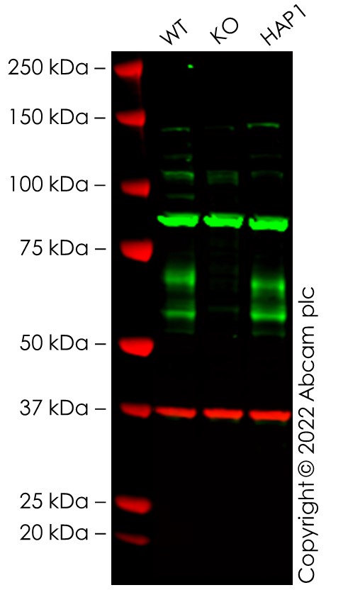 Western blot - Anti-BACE1 antibody [EPR3956] - BSA and Azide free (AB237595), expandable thumbnail