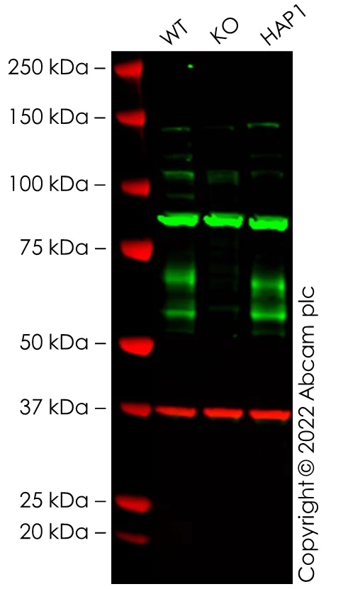 Western blot - Anti-BACE1 antibody [EPR3956] - BSA and Azide free (AB237595)